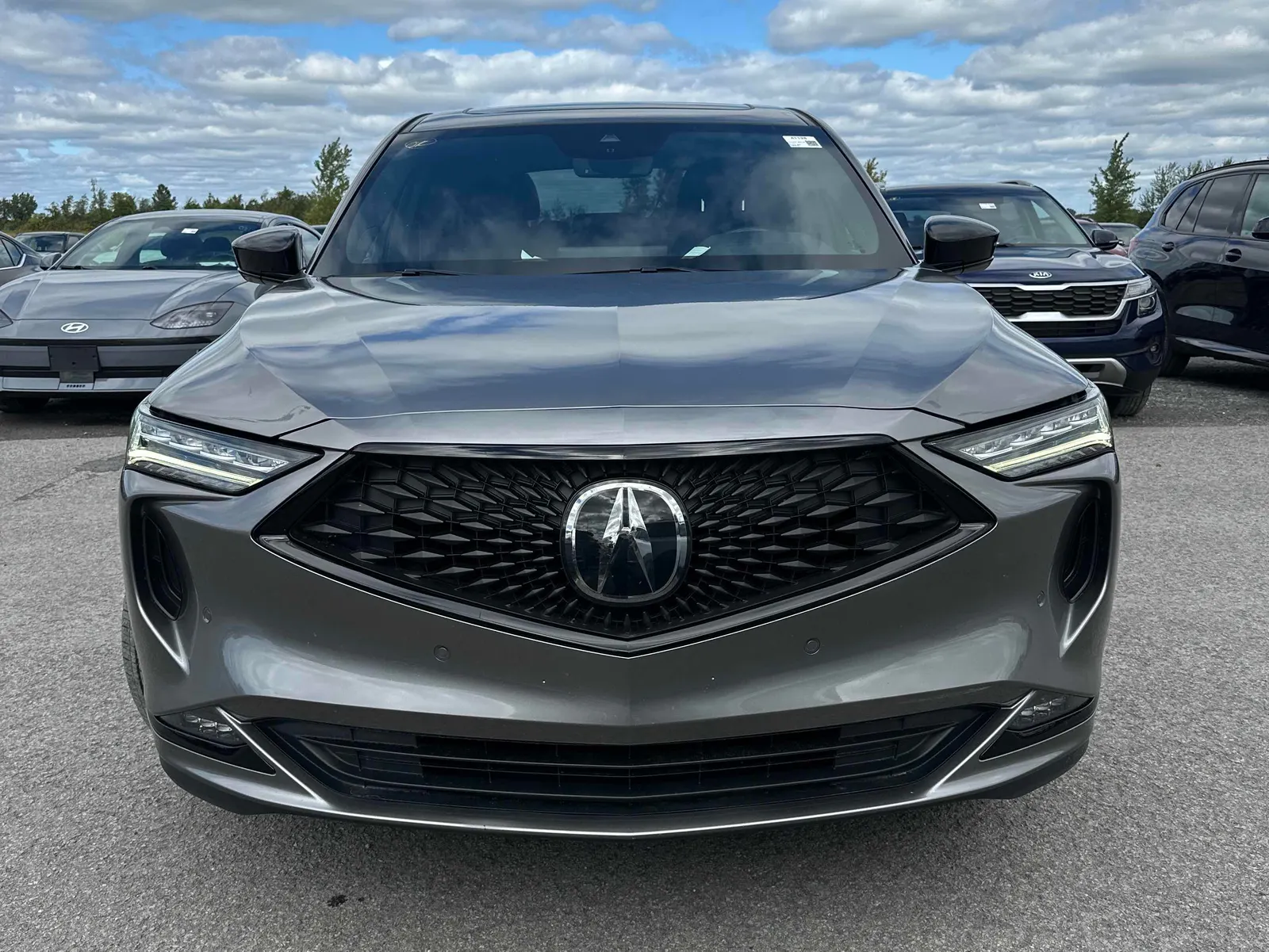Front