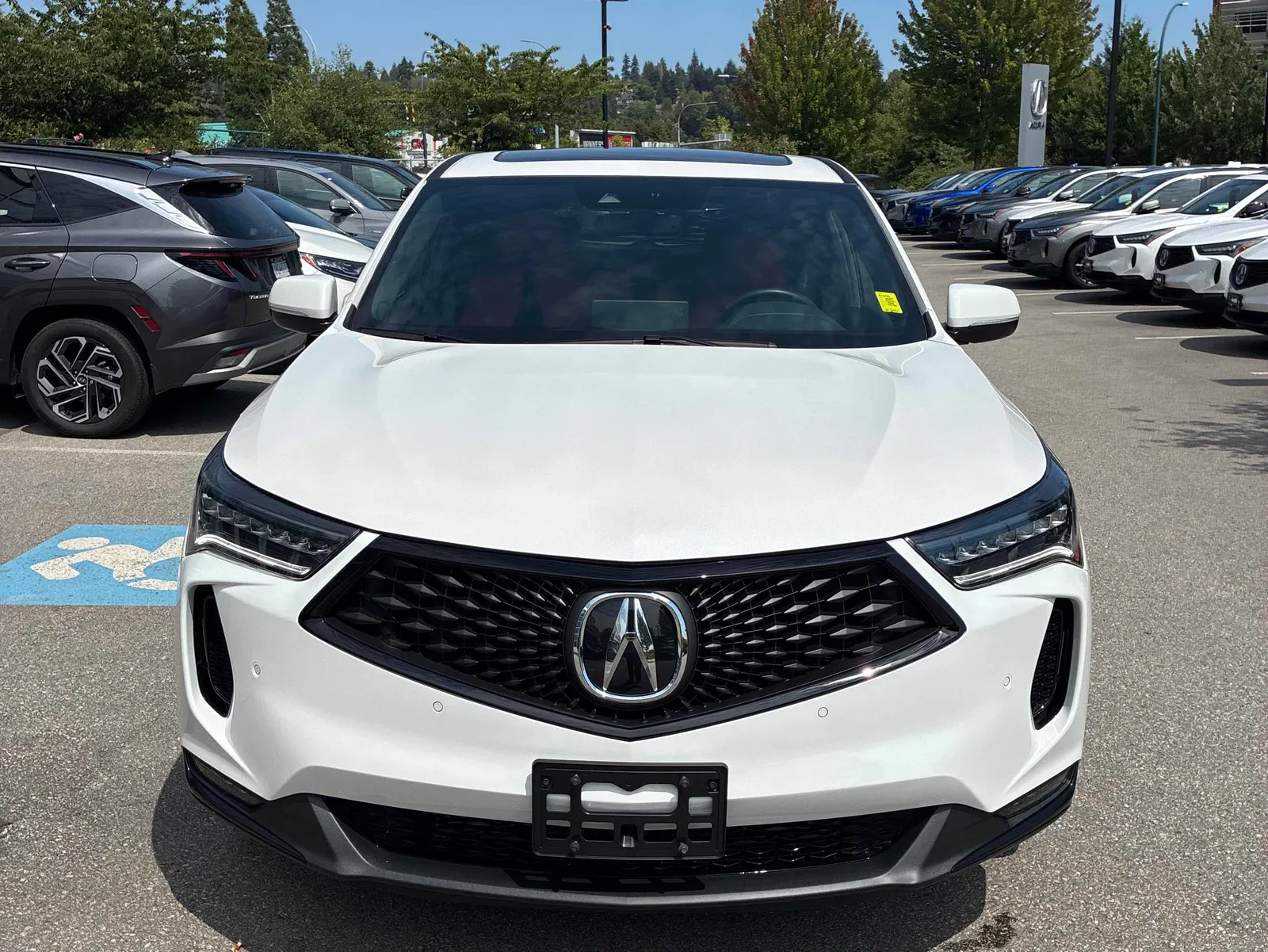 Front